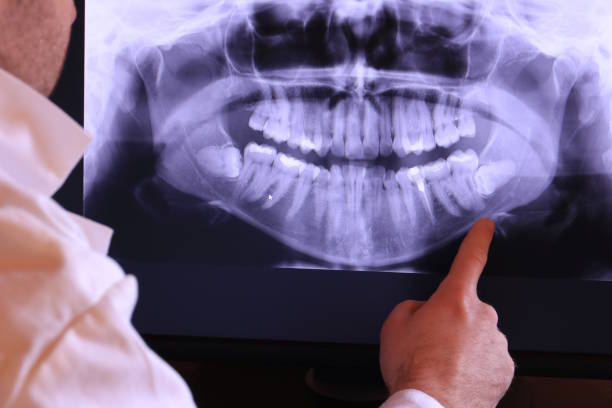 Emergency Dentist for Kids in WV
